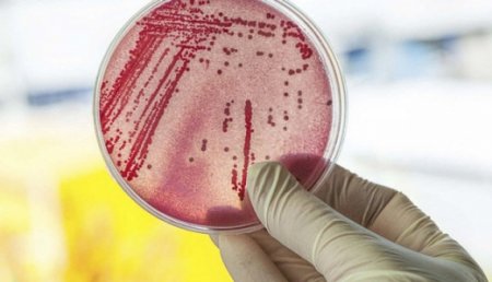 Ғалымдар бедеулік ауруын тудыратын супербактерияны анықтады