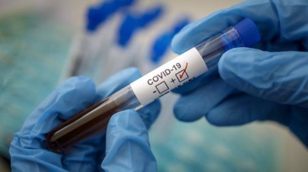 Қызылордада COVID-19 вирусын жұқтырғандар саны 72-ге жетті