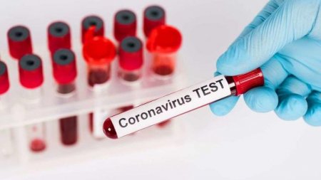 Қызылордада «COVID-19» вирусын жұқтырғандар қатары 448-ге жетті