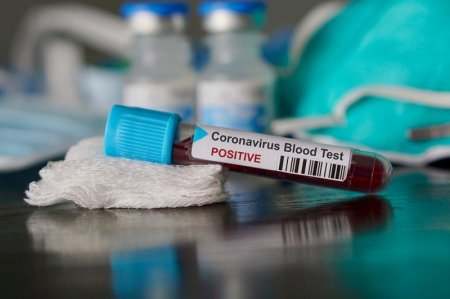 Қызылордада соңғы тәулікте коронавирус жұқтырған 74 адам тіркелді