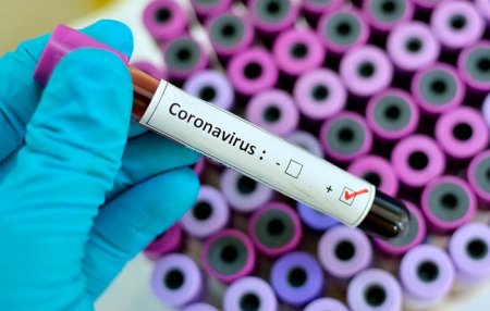 Қызылордада тағы 2 адамнан короновирус инфекциясы анықталды