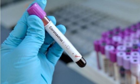 Қызылордада өткен тәулікте 87 адамнан коронавирус анықталды