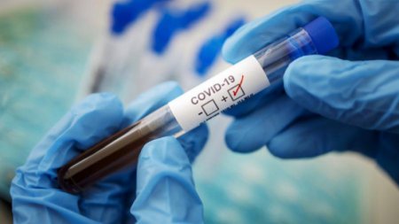 Қызылордада өткен тәулікте 21 адамнан коронавирус анықталды