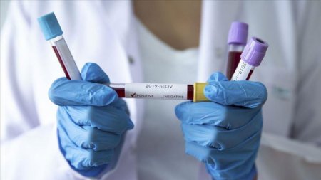 Қызылордада өткен тәулікте 54 адамнан коронавирус анықталды