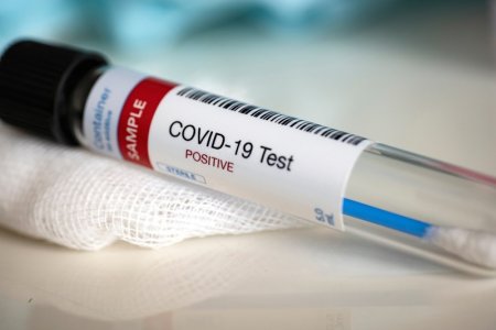 Қызылордада 65 адамнан коронавирус анықталды