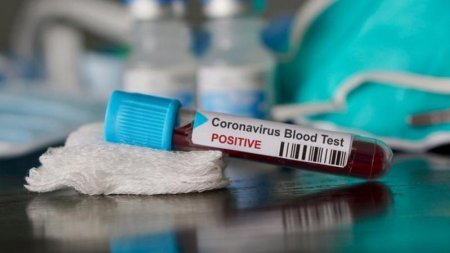 Қызылордада өткен тәулікте коронавирус инфекциясын 31 адам жұқтырған