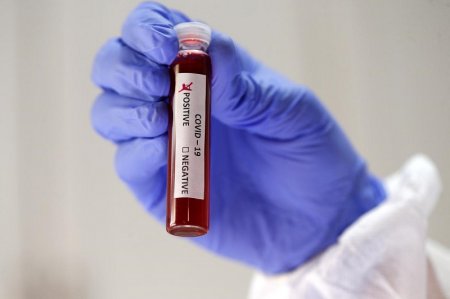 Қызылордада өткен тәулікте 18 адамнан коронавирус анықталды