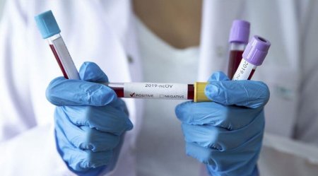 Қызылордада 23 адамнан коронавирус инфекциясы анықталды