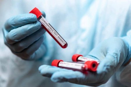 Қызылорда: Өткен тәулікте бірнеше адамнан коронавирус анықталды