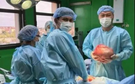 Қызылордада 72 жастағы әйелден 5 килограмм киста алынды
