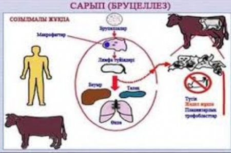 Сарып ауруынан сақтаныңыз!