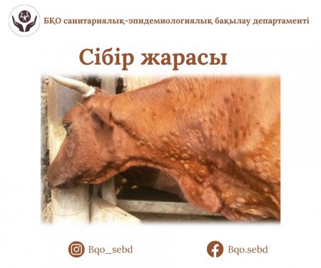 Сібір жарасы ауруынан сақтаныңыз
