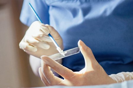 АПВ вирусының қатерлі ісік шақыратын түрлері қауіпті