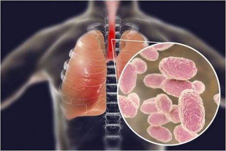 Көкжөтел ауруының эпидемиологиялық жағдайы және алын алу шаралары