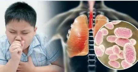 Ақзия Қасымқызы: Көп жағдайда бұл аурумен балалар ауырады