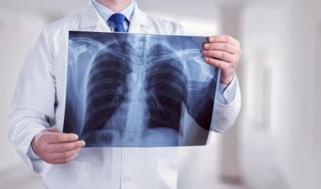 Туберкулез ауруының эпидемиологиялық ахуалы және одан сақтану жолдары