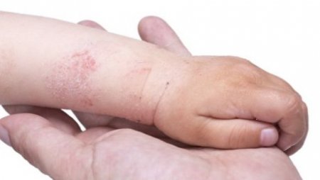 Ақзия Қасымқызы: Дүние жүзінде жұқпалы аурулардың түрлері мыңдап саналады