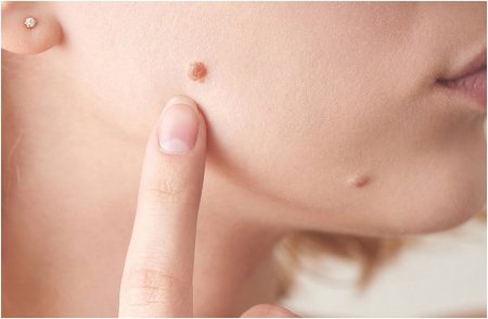 Адам папиллома вирусы және одан қорғану жолдары