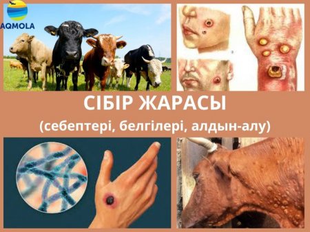 Сібір жарасы ауруынан сақтаныңыз!