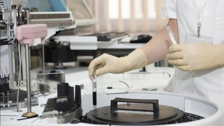 Грекияда Батыс Ніл безгегінен қайтыс болғандар саны артып келеді